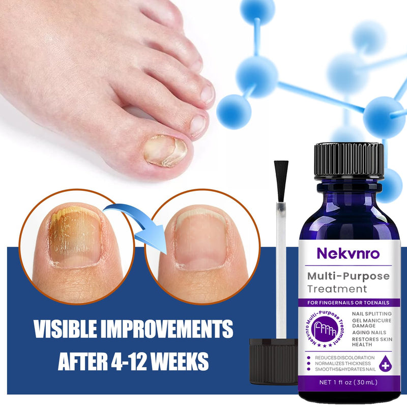 Toenail Fungus Treatment Extra Strength,Nail Fungus Treatment for Toenail,Fungus Nail Treatment Liquid 30ML and Fungal Nail Repair Cream.