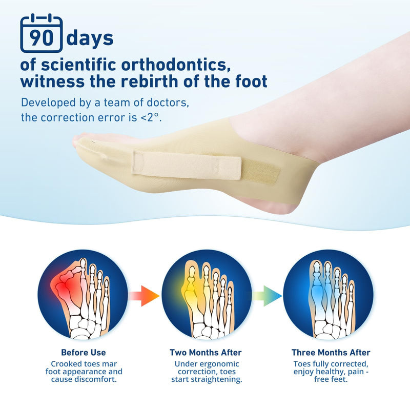 2 Pcs Bunion Corrector & Adjustable Toe Spacer for Women & Men-Big Toe Support with Side & Heel Straps, Hallux Valgus Pain Relief, Comfortable for Day & Night. (2, Beige, M) 1 - BeesActive Australia