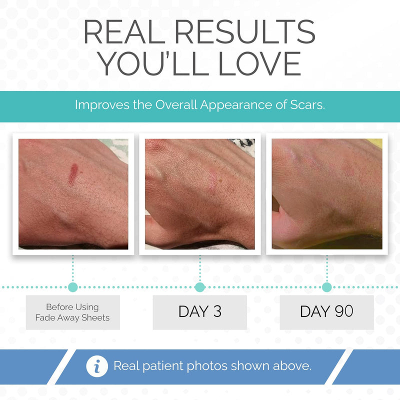Clinically Proven Silicone Scar Sheets ‚Äì Medical Grade Tape for Surgery, C-Section, Keloids & Tummy Tuck Scars - BeesActive Australia