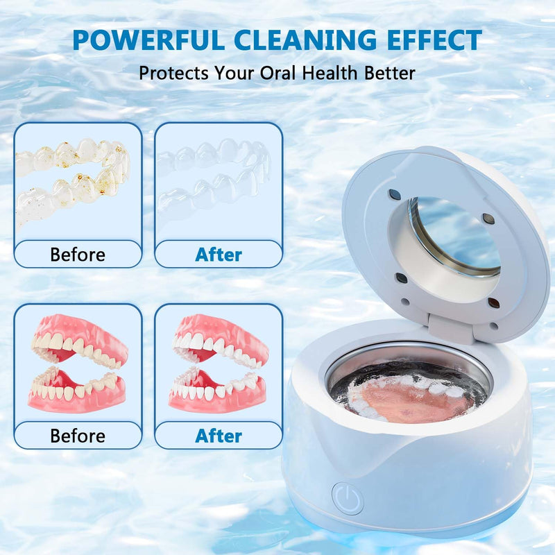 Ultrasonic Retainer Cleaner Machine 45kHz 200ml Portable Ultra Sonic Retainer Cleaner for Dental Retainer Mouth Guards Aligner Night Guard Braces Toothbrush Jewelry - BeesActive Australia