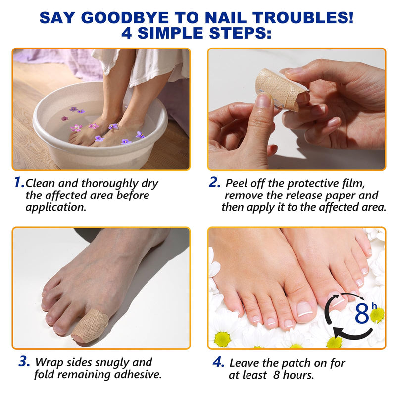 32 PCS Fungal Nail Patches for Broken Damaged Split Nails,Toenail Treatment Extra Strength,Nail Repair for Damaged Nails, Nails Care Supplies, Restore Discoloration and Thickness (2 Pack) 32 Count (Pack of 1)