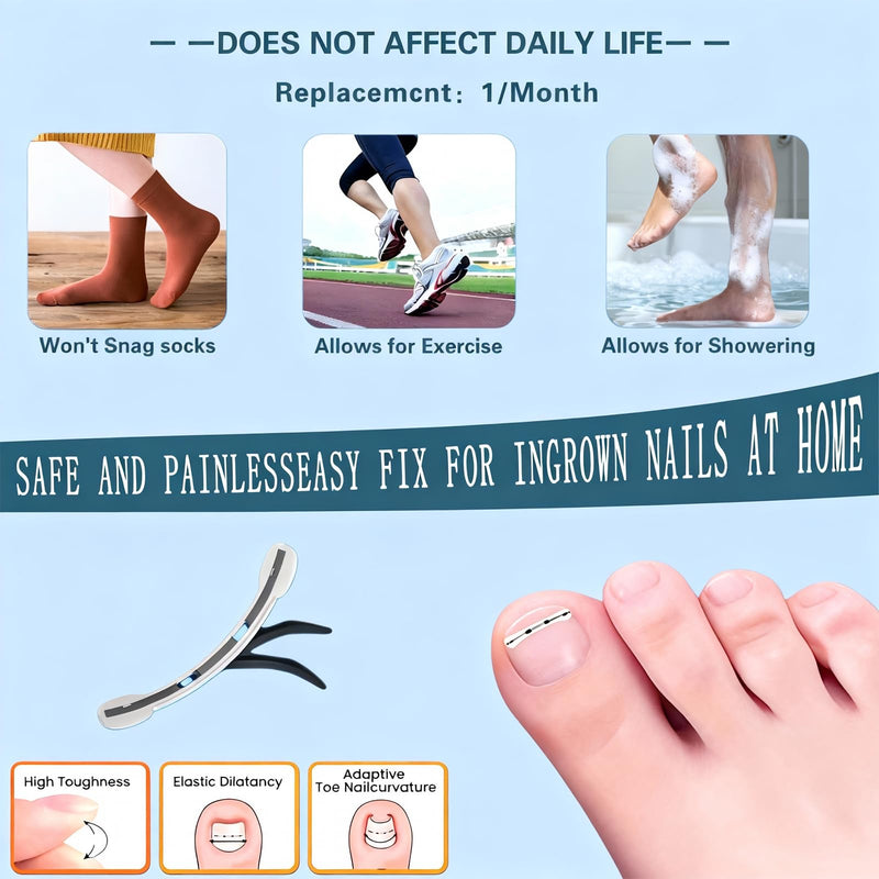 Titanium Alloy Ingrown Toenail Treatment - Professional Home Care for Curved Nails - Waterproof, Nail Tools and Ingrown Toenail Removal Kit,Ingrown Toenail Corrector(0.59/0.67in) Blue