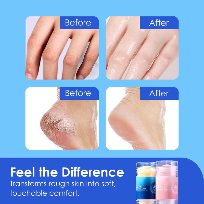 Crack Feet Prevention Stick (2-Pack) | Moisturizing Heel Balm & Foot Balm Stick for Dry, Cracked Feet | Anti-Crack Foot Cream Sticks for Softening, Nourishing, Smoothing Rough Heels & Dry Skin