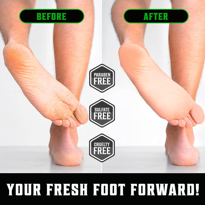 Viking Revolution Tea Tree Foot Cream for Dry Cracked Heels - Foot Balm For Cracked Feet - Dry Feet Repairing Cream with Aloe Vera and Mint (8oz) 8 Ounce (Pack of 1) - BeesActive Australia