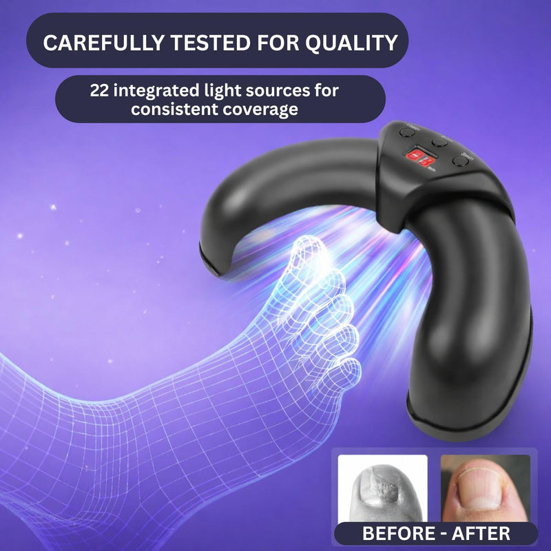 Nail Fungus Blue Light Therapy Device for Toenails & Fingernails, Home Use Toenail Fungus Treatment Device for Onychomycosis