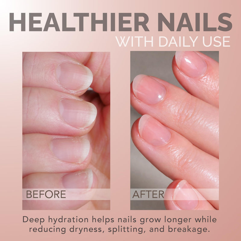 Perfect Formula HydraGrow Cuticle Hydration Nail Growth Oil Pen With Vitamin E Jojoba Oil and Aloe Vera for Strong & Healthy Looking Nails - Travel Friendly Manicure Brush - 3 ml