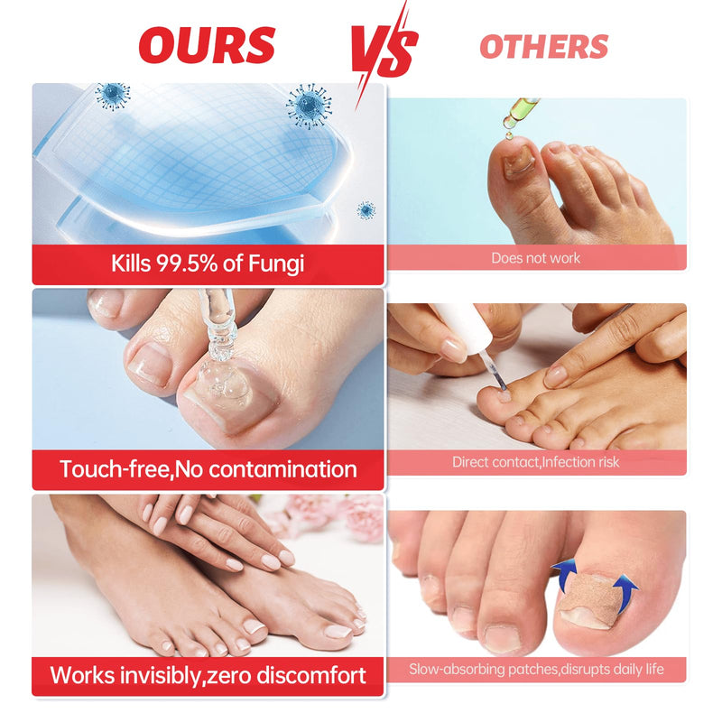Nail Fungus Treatment Extra Strength - 25% Undecylenic Acid, Gentle Plant Formula for Fingernails, Treats Under & Around Nail, Treatment Discoloration, Repair Thick, Damaged Nails, 2.02Fl.oz 2.02 Fl Oz (Pack of 1)