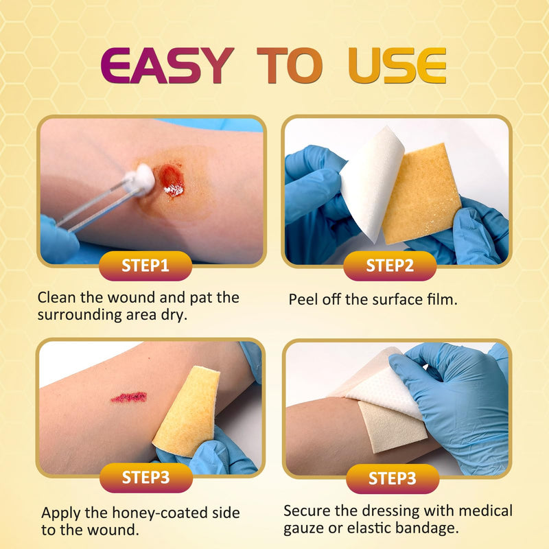 Honey Calcium Alginate Wound Dressing – 2"x2" 10 Packs – Medical Grade Manuka Honey, High Absorbency, Forms Gel & Non-Stick – for Chronic Wounds, Post-Surgery, Pressure Injuries, Burns, Cuts - BeesActive Australia