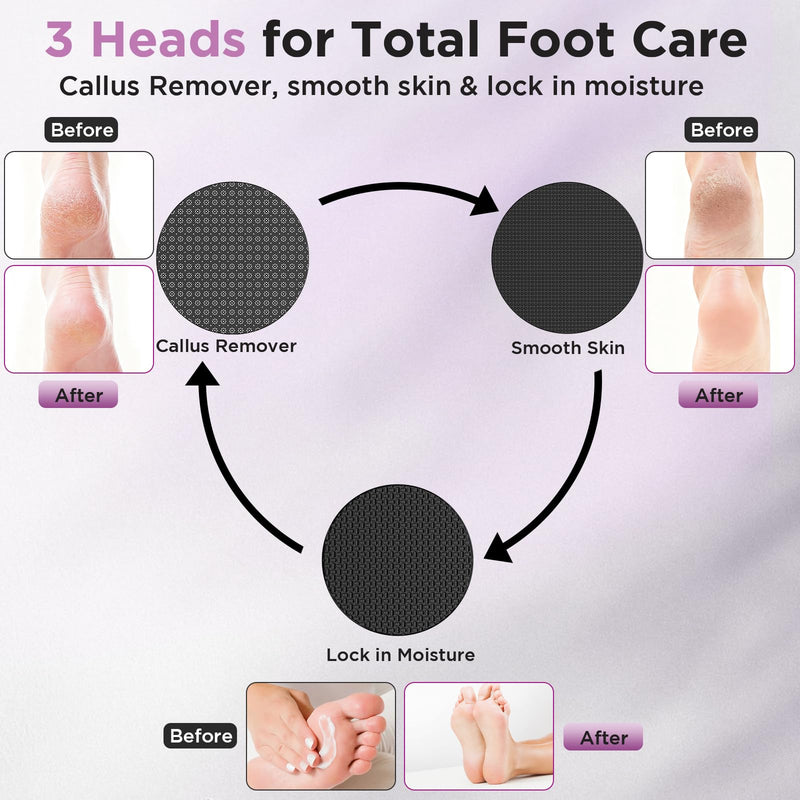 Electric Foot Callus Remover, Apply Oil,Foot SPA,Foot File,Reusable Nano-Glass Head, Ergonomic Premium Aluminum Callus Remover for feet, Rechargeable Pedicure Tools for Feet,Gifts for Men Women pink - BeesActive Australia