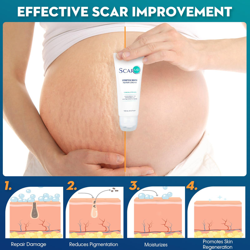 Stretch Mark Repair Cream is Formulated with Botanical Ingredients to Effectively Minimize Stretch Marks for a Smoother, More Even Skin Tone 3.52 f oz Stretch Mark Repair Cream - BeesActive Australia