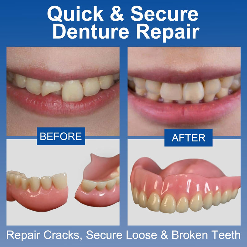 Dental Lab Instant Bonding Dental Glue (1 oz), Repair Cracks, Secure Loose & Broken Teeth, Super-Strong Denture Adhesive, Lasting for Days to Weeks, Clear Color, Non-Irritating Odor - BeesActive Australia