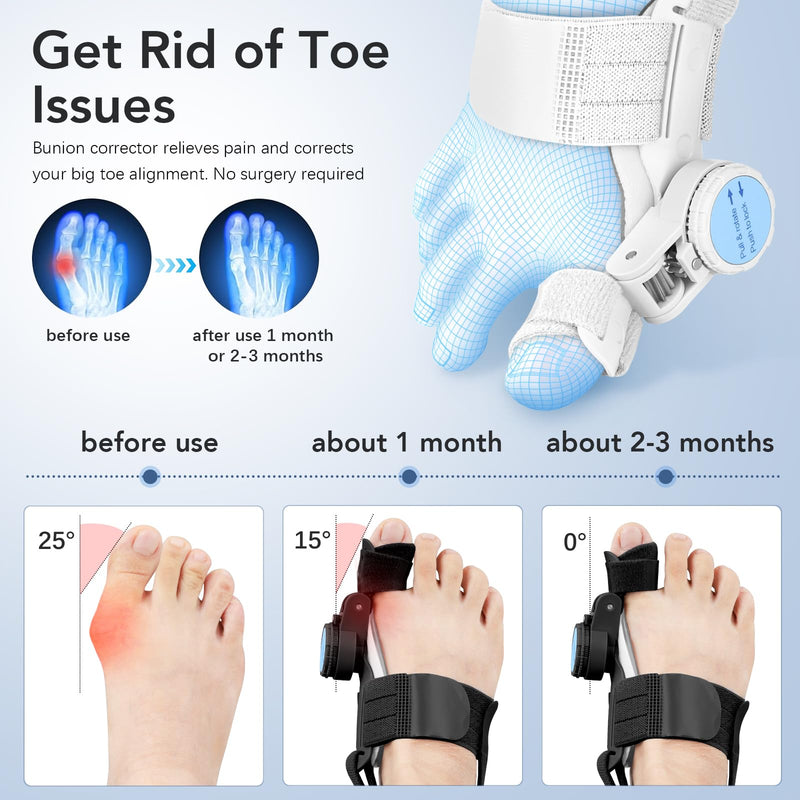 Bunion Corrector for Women Men: Big Toe Straightener Bunion Fix with Adjustable Knob-Orthopedic Bunions Splint Brace Toe Alignment Correction for Hallux Valgus Pain Relief Day/Night 1PCS (Black) Black