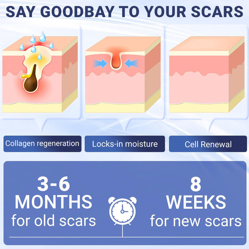 Scar Cream, Silicone Scar Gel, Advanced Scar Removal Cream for Surgical Scars, Stretch Marks Removal, Keloid Bump Removal, Old and New Scars 2.11 Oz (60g) Scar Cream 2.11 Ounce
