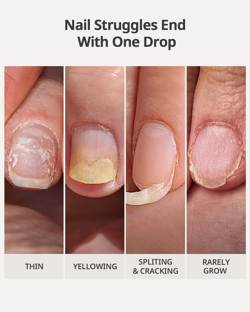 BTARTBOXNAILS Naillush Nail Strengthener & Growth - Repair Damaged Nails, Strengthen Weak & Thin Nails, Extra Strong Nail Growth Treatment, Long Lasting Nail Hardener, 15ml C-Naillush Nail Strengthener & Growth 15ml - BeesActive Australia