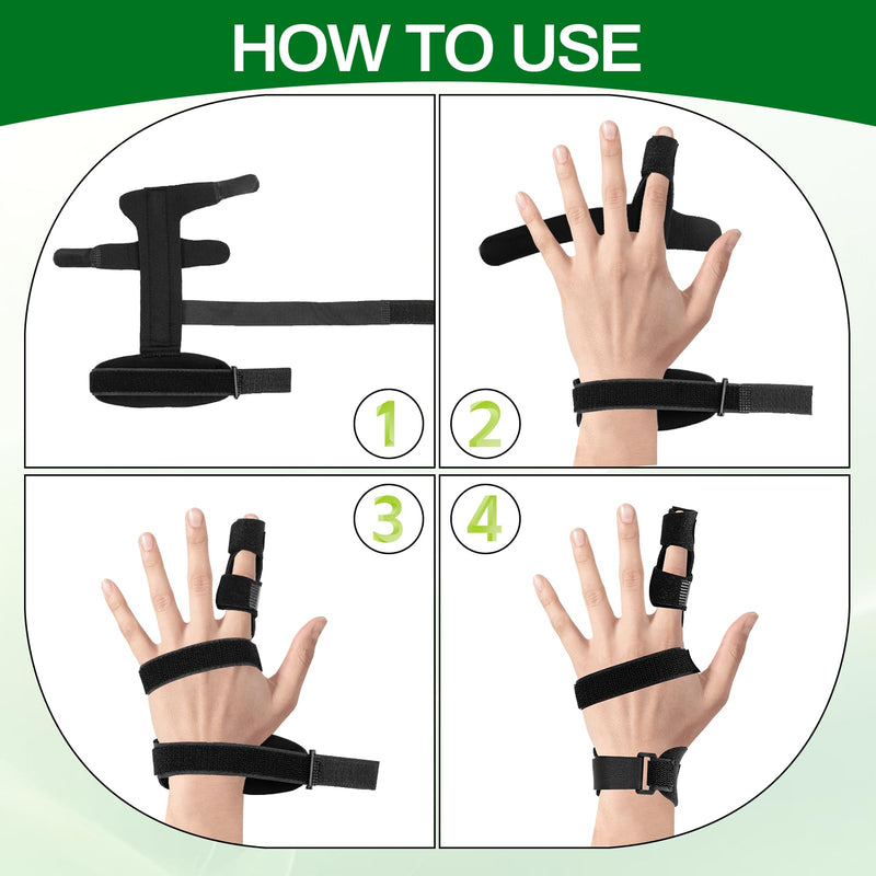 2-Pack Adjustable Finger Splints for Trigger Finger & Joint Pain Relief - Universal Fit Brace Supports All Fingers for Arthritis, Tendinitis & Carpal Tunnel - BeesActive Australia