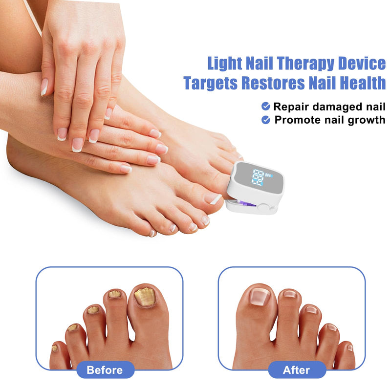 Nail Cleaning Light Device,Toenails & Fingernails Care, Home Use Nail Fungus Light Treatment Device for Multiple Nails, USB Rechargeable