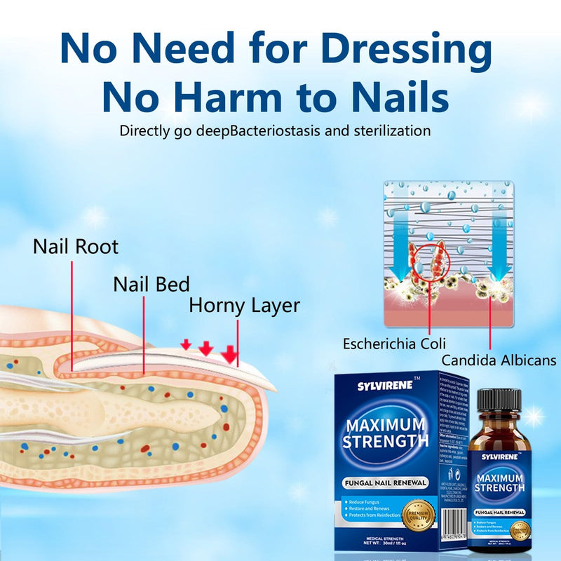 Toenail Fungus Treatment Extra Strength, 30ML Fungus Nail Repair Liquid with 1% Tolnaftate, Fast Acting Treatment for Discolored & Damaged Nails, Athletes Foot 1 Fl Oz (Pack of 1)