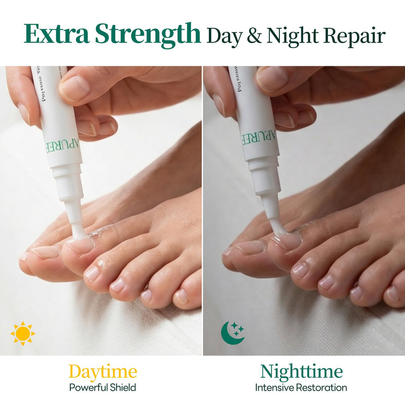 Apuree Antifungal Pen Extra Strength: 25% Undecylenic Acid 1% Tolnaftate| FSA-HSA| 24/7 Day & Night Care | 2Pcs Nail Fungus Pen | Nail Treatment Repair For Damaged Yellow Discolored Thick Nails 0.5 Fl Oz (Pack of 1) - BeesActive Australia