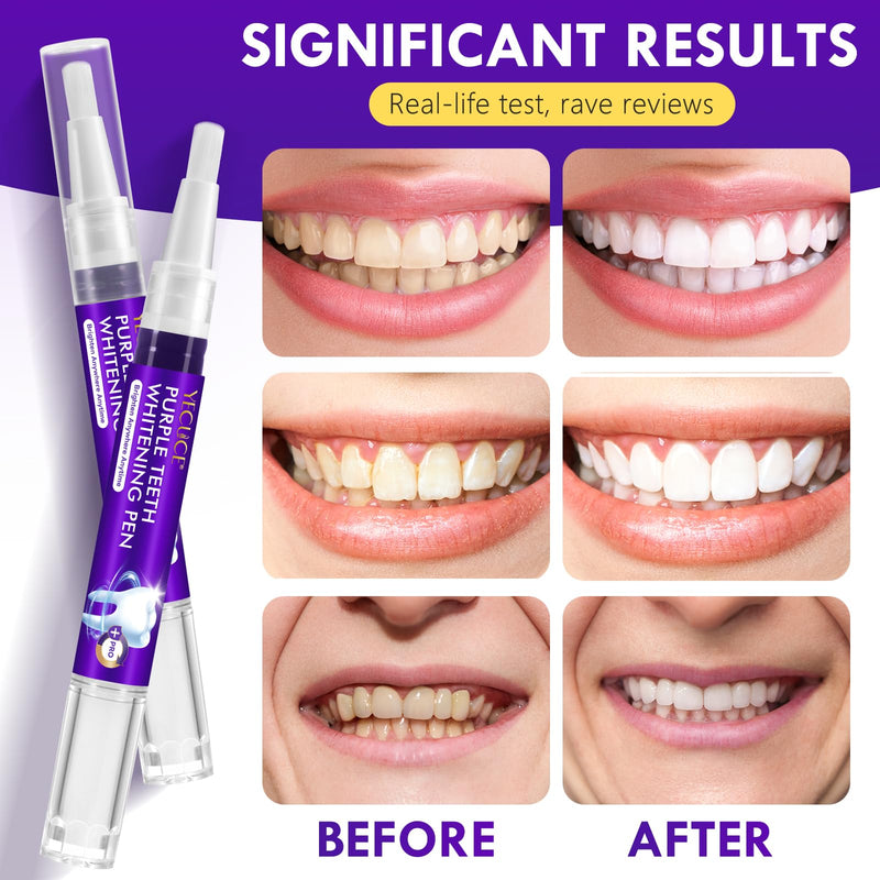 Teeth Whitening Pen 6 Pack, Professional Purple Teeth Whitening Gel for Rapid Stain Removal, No Sensitivity Formula for Sensitive Teeth, Mint Fresh Breath