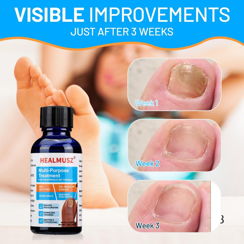 Toenail Fungus Treatment Extra Strength – Fast Acting Repair for Healthy Nails.