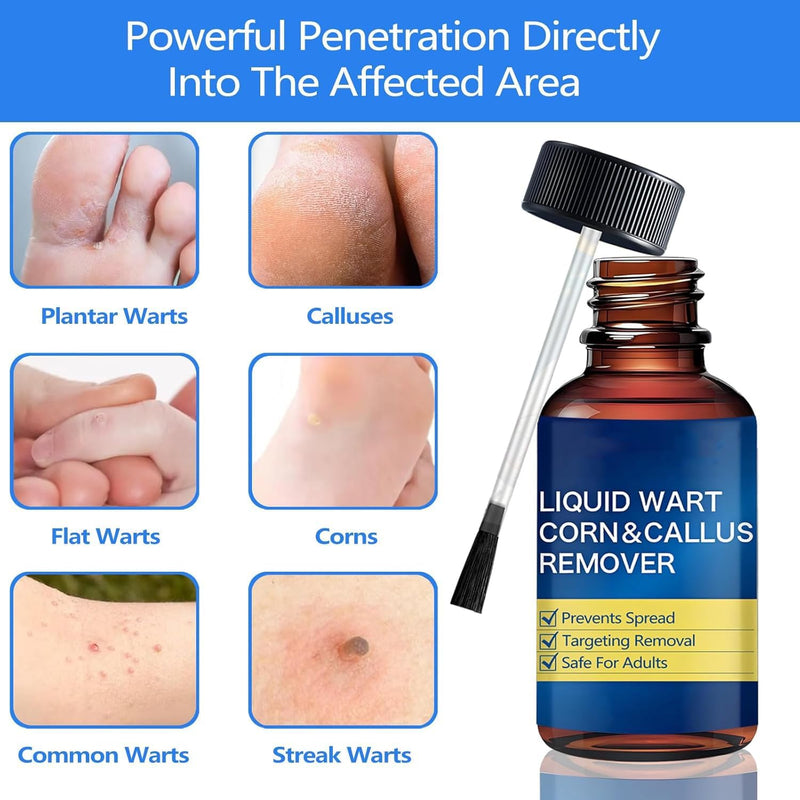 Corn Removers for Toes: Liquid Salicylic Acid Corn Removal for Feet - Corn Callus Remover for Feet Extra Strength (0.5 Fl Oz) 0.5 Fl Oz - BeesActive Australia