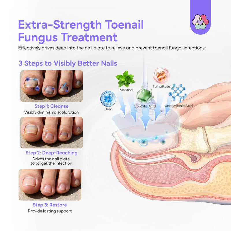 SAVILAND Toenail Fungus Treatment Extra Strength: 2X Extreme Nail Repair for Discolored and Damaged Nails Toenail Softener Yellow Toenail Foot Toe Thick Nail Fungus Treatments Solution,2 fl oz - BeesActive Australia