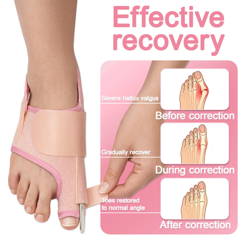 SPRING SEAON 2-Pack Bunion Corrector for Women & Men, Interchangeable 2-Level Stiffness Plates, Adjustable Big Toe Splint Toe Brace for Hallux Valgus, Day/Night Support, Toe Straightener (Pink) Pink