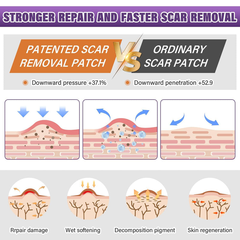 Silicone Scar Sheets,Silicone Scar Tape,Silicone Scar Removal Strips for Surgical,C-Section,Tummy Tuck,Keloid Scars (1.6"X 59" Roll-1.5M) Keloid Bump Removal 1.5M - BeesActive Australia