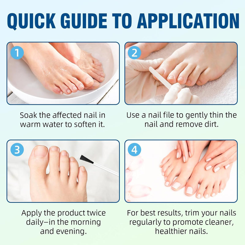 Toenail Fungus Treatment Extra Strength ‚Äì 25% Undecylenic Acid Antifungal Solution for Thick, Discolored Nails ‚Äì Podiatrist Recommended with Tea Tree, Aloe Vera & Soothing Botanicals (1 Pcs) 1 Fl Oz (Pack of 1) - BeesActive Australia