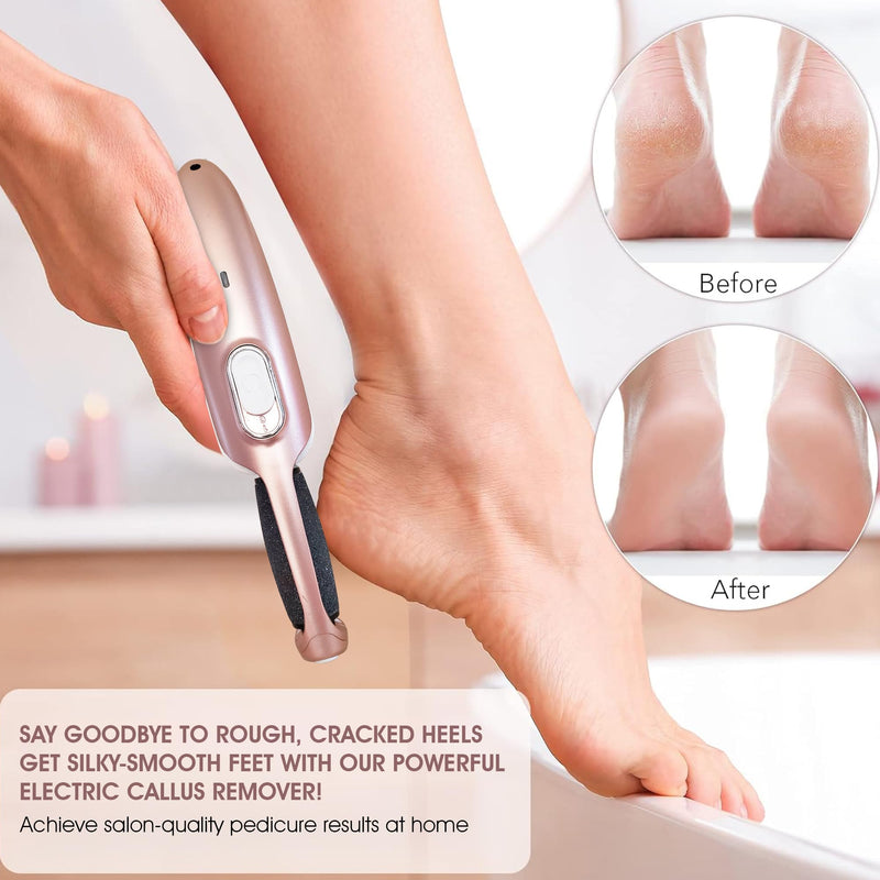 Powerful Electric Callus Remover Wand – Rechargeable Foot File, Grinder & Scrubber - Removes Dead, Hard Skin & Calluses – Best Pedicure Tool for Soft, Smooth Feet for Men & Women (Rose Gold) Rose Gold - BeesActive Australia