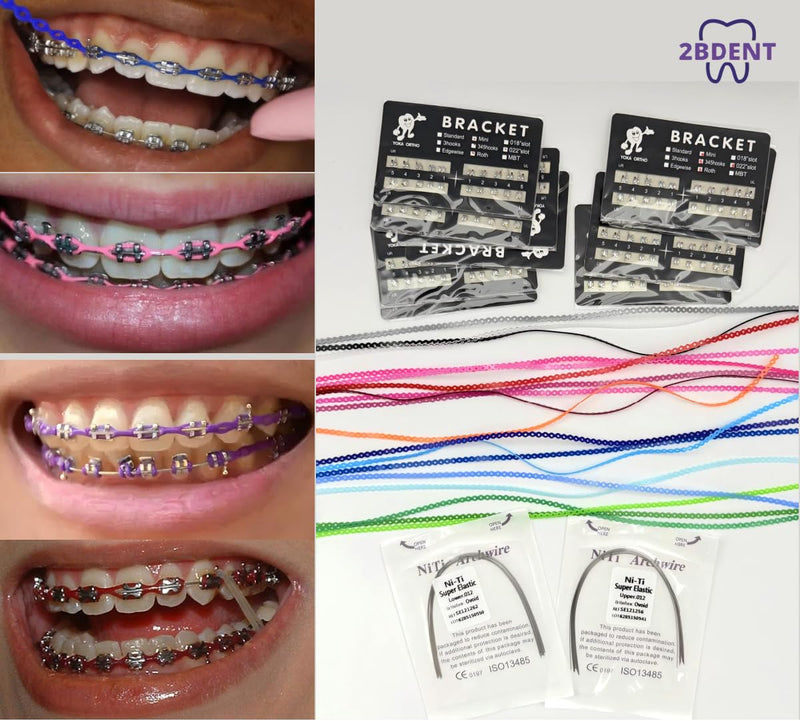 Decorative Braces-Style Kit