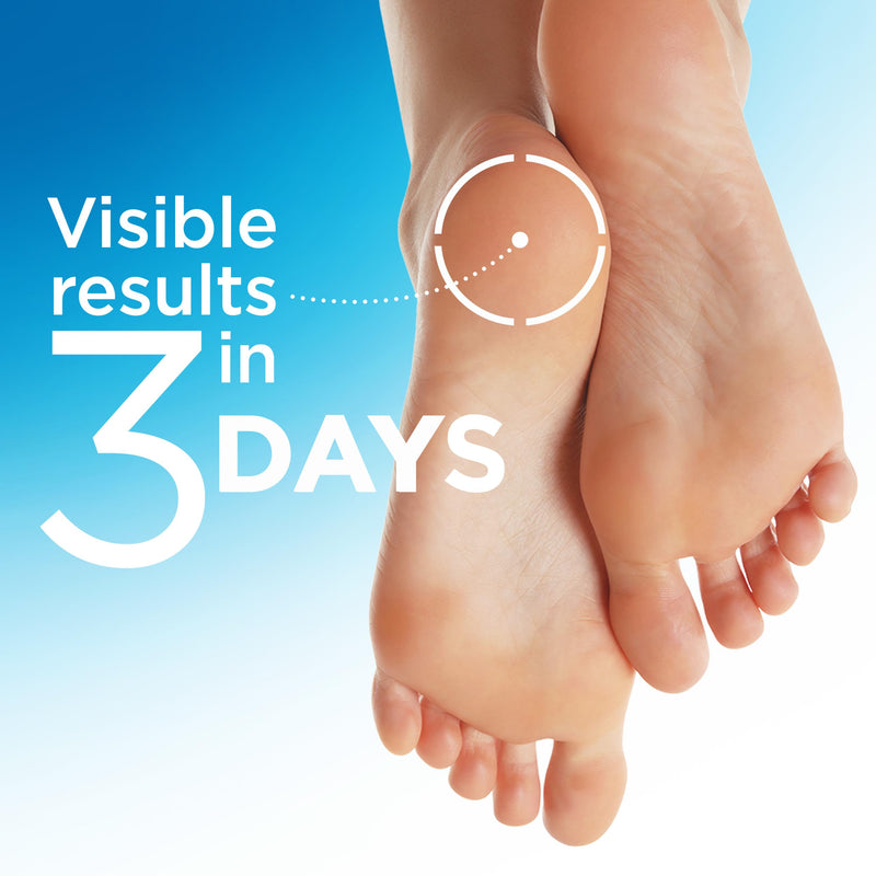 Flexitol Heel Magic Stick, Cracked Heel Cream & Foot Balm, Urea-Based Moisturizing Stick with Shea Butter & Vitamin E, 2.5 oz 2.5 Fl Oz (Pack of 1)