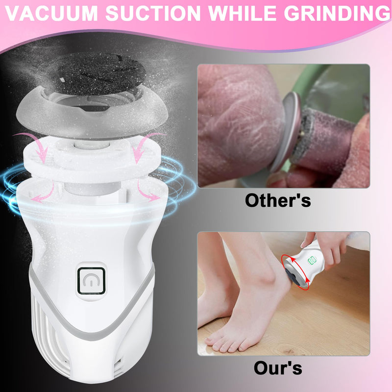 Electric Foot Callus Remover for Women Men, Rechargeable Electric Foot File Pedicure Tool with 2 Speeds and 6 Grinding Heads, Portable Feet Grinder for Cracked Dry Heels Dead Skin Calluses - BeesActive Australia