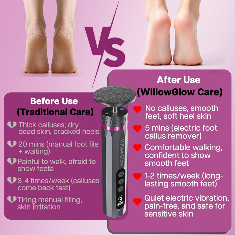 Professional Electric Foot Callus Remover, 9-Speed Cordless Foot File with Reusable Nano Glass Heads & Sandpaper for Dead Skin Removal and Smooth Feet - BeesActive Australia