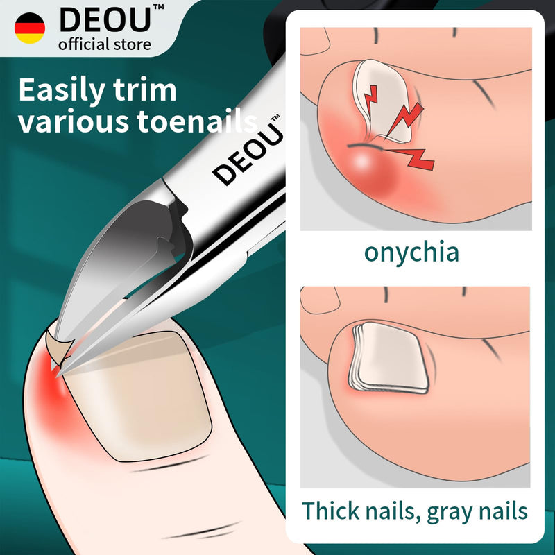 DEOU Toenail Clippers Blade for Ingrown and Thick Nails Stainless Steel Pedicure Tools at Home ingrown toenail Treatment Professional Podiatrist Nail Clippers with (Eagle Beak Pliers+Nail Remover) Eagle Beak Pliers+nail Remover
