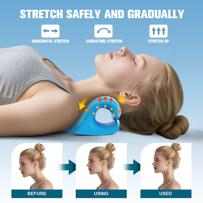 Neck Stretcher and Cervical Traction Device, Relaxer for TMJ Pain and Shoulder Pain Relief, Cervical Traction Device Pillow, Spine and Neck Corrector(Blue) - BeesActive Australia