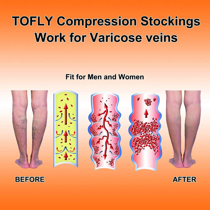 TOFLY® Calf Compression Sleeve for Men & Women, 1 Pair, Footless Compression Socks 20-30mmHg for Leg Support, Shin Splint, Pain Relief, Swelling, Varicose Veins, Maternity, Nursing, Travel, Black L Large (1 Pair) - BeesActive Australia