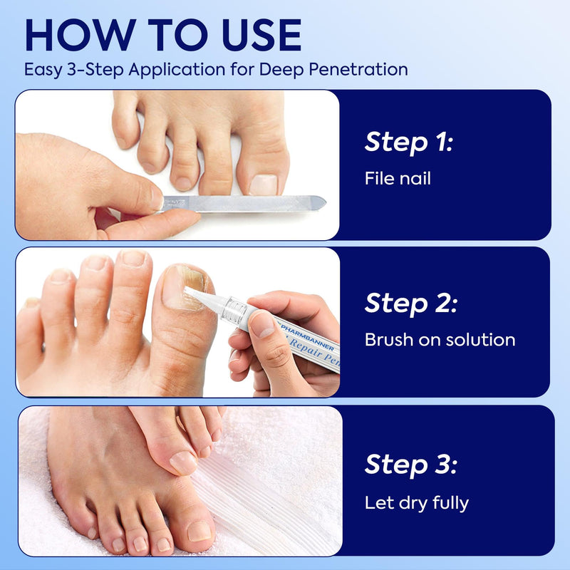 Nail Fungus Treatment Extra Strength: 25% Undecylenic Acid Formula - Toenail Fungus Treatment Kit with 5 Pens & Nail File for Ingrown Nails, Discoloration & Brittle Nails 0.1 Fl Oz (Pack of 5)