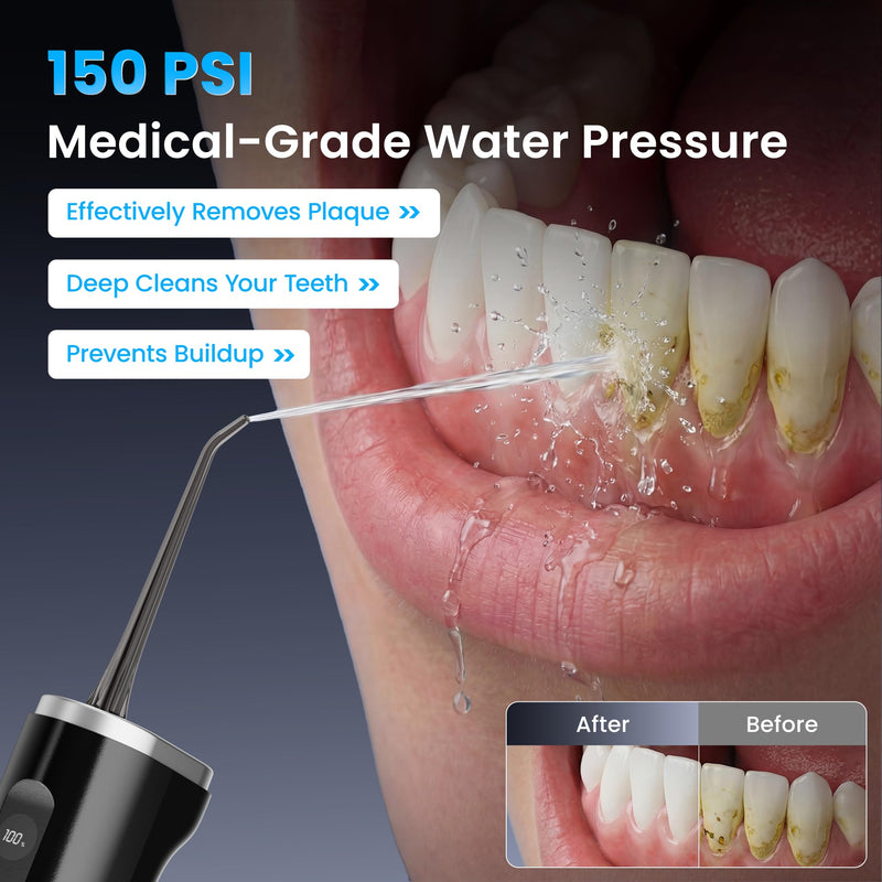 Water Flosser Teeth Picks, 100 Power Levels (150-PSI Variable Pressure) Cordless Floss for Tooth Cleaning and Flossing, 300ml Capacity Electric Floss Oral Irrigator for Adults Black