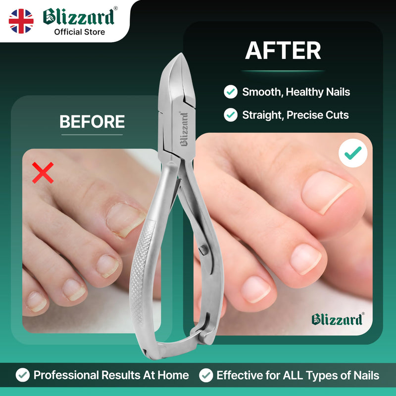 Nail Clippers for Men with Thick or Ingrown Toenails – Blizzard Podiatrist Toenail Clipper Set German Forged – 5.5 inch Heavy Duty Nail Cutter – Concave Head Chequered Handles - Hospital Grade 14cm - Concave Head - Chequered Handles