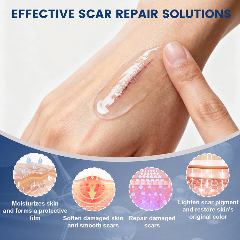 Rvlaim 100% Silicone Scar Gel Scar Cream, Advanced Silicone Gel for Removal of Surgical, Burns, Acne Scar, Old and Recent Scars and Stretch Marks, 1.7 oz/50ml 50ML