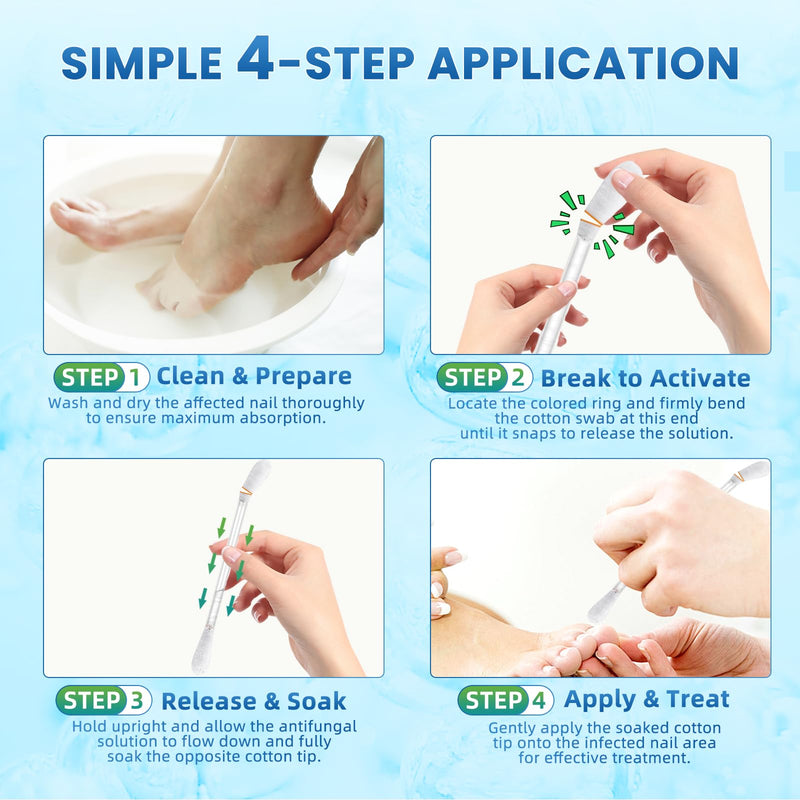 Fungal Nail Treatment Swabs–100 Ct, Extra Strength Toenail & Athlete’s Foot Fungus Treatment with 25% Undecylenic Acid, Damaged, Discolored & Thick Nails, Restores Healthy Nail Growth