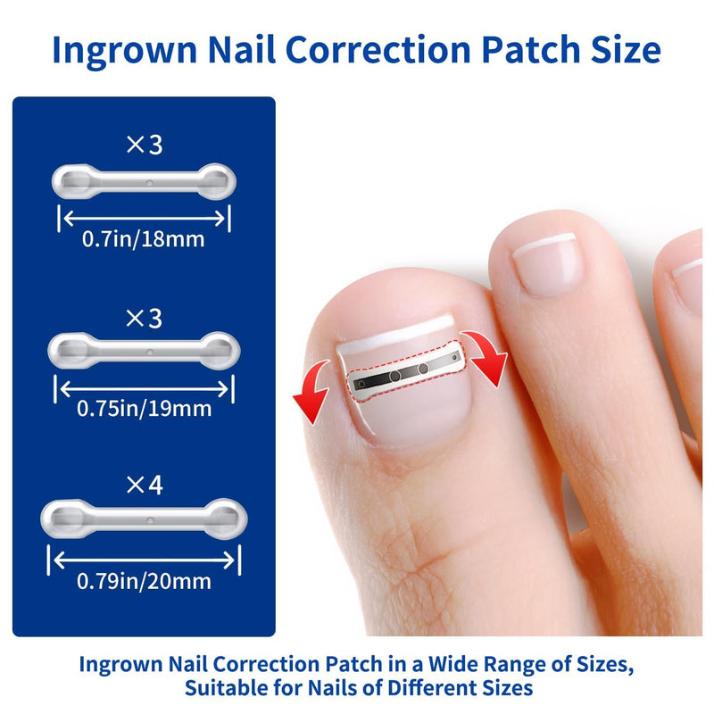 Ingrown Toenail Treatment, 10 packs Titanium Alloy Ingrown Toenail Corrector for all size foot, Ingrown Toenail Removal Kit for Curved Nail Repair, at Home Nail Kit Tools-Blue03