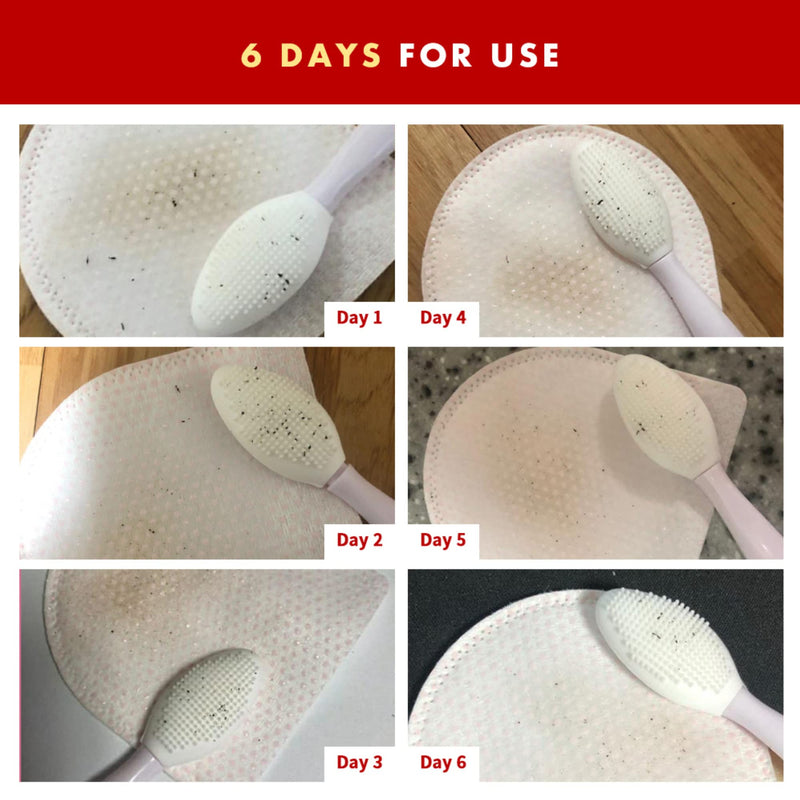 Black Seed Brush - Cat Acne Chin Treatment, Cat Acne Brush, Silicone Brush for Cats Chin Acne & Blackhead Exfoliation, Double-sided Cat Grooming Brush (1PCS) 1 - BeesActive Australia