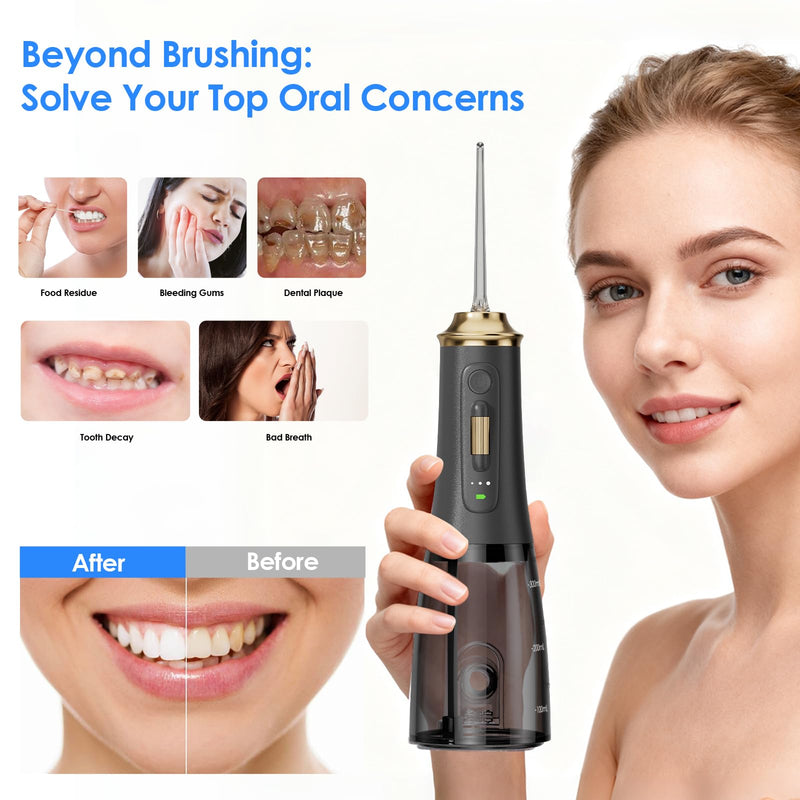 300ML Long-Lasting Battery Life Water Flosser Adjustable Pressure Oral Irrigator Flosser with 4 Interchangeable Nozzle Tips for Implants/Braces/Receding Gums (Black&Gold) Black&gold