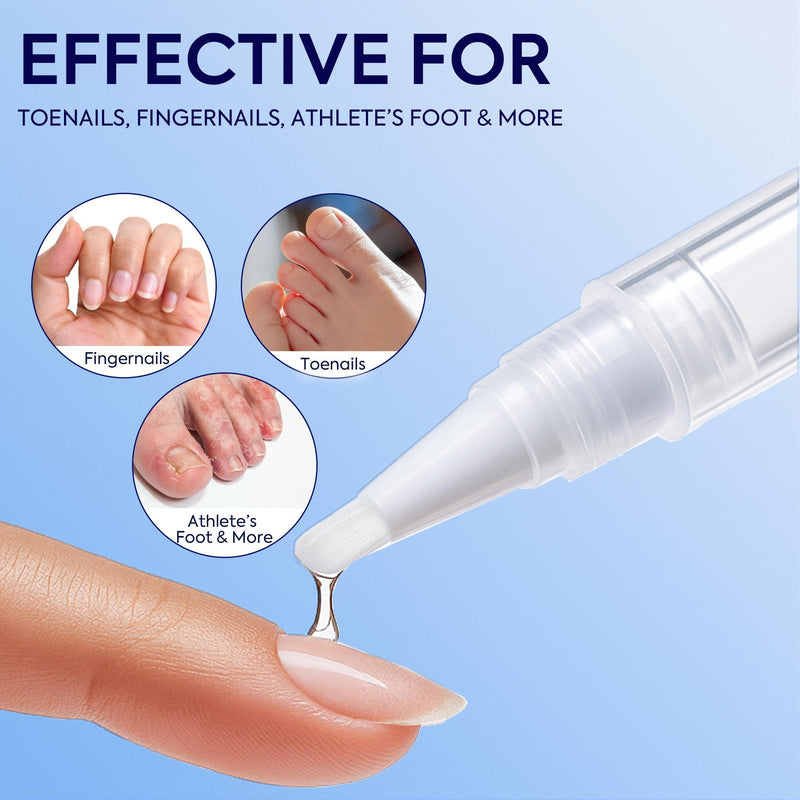 Nail Fungus Treatment Extra Strength: 25% Undecylenic Acid Formula - Toenail Fungus Treatment Kit with 5 Pens & Nail File for Ingrown Nails, Discoloration & Brittle Nails 0.1 Fl Oz (Pack of 5)