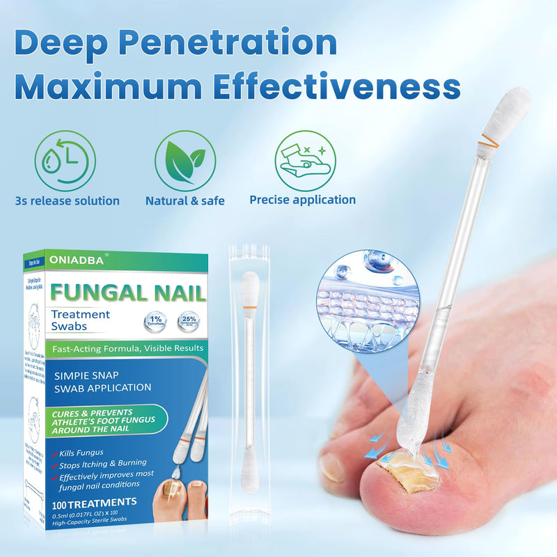 Fungal Nail Treatment Swabs–100 Ct, Extra Strength Toenail & Athlete’s Foot Fungus Treatment with 25% Undecylenic Acid, Damaged, Discolored & Thick Nails, Restores Healthy Nail Growth