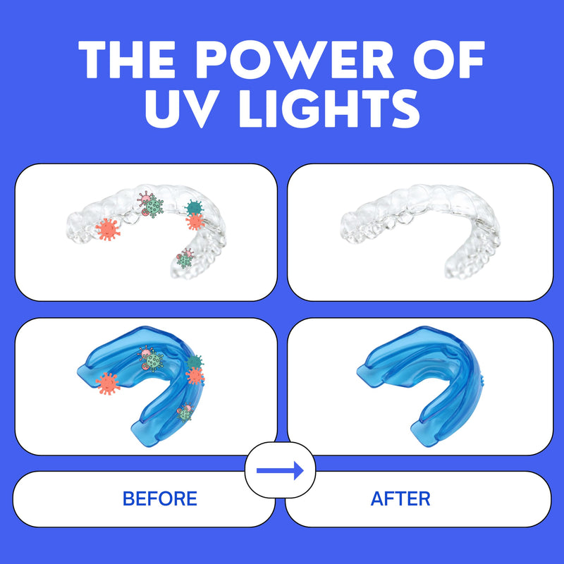 UV Retainer Case for Invisalign, Aligners, Dental Braces, Mouth Guard, Dentures and Night Guard - Small and Portable UV Retainer Cleaner Case with UVC Lights (Pink & White) Pink + White