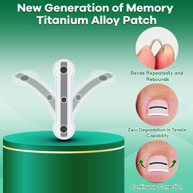 Titanium Alloy Ingrown Toenail Corrector New Version Ingrown Toenail Removal Tool Kit, Designed for Curved Nail Repair Big Toe Ingrown Toenail - BeesActive Australia