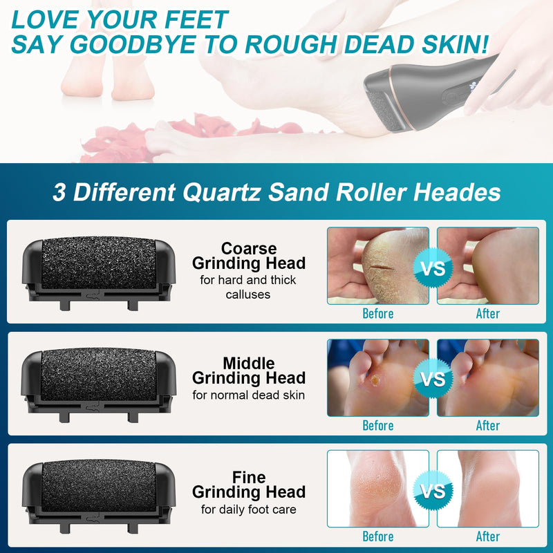 Electric Callus Remover for Feet Rechargeable Portable Electronic Foot File Pedicure Tools 16 In 1 Foot Callus Remover Kit Foot Scrubber Professional Foot Care To Remove Dead Skin Hard Skin Dry Cracks Black Electric Callus Remover +16 In1 - BeesActive Australia